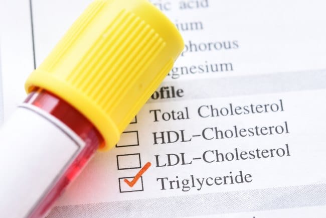 Trigliserida, Ini Penyebab dan Cara Mengatasi Jika Kadarnya Terlalu Tinggi - Alodokter