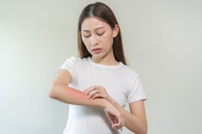 Bintik Demam Berdarah, Ini Ciri-Ciri dan Penanganannya - Alodokter