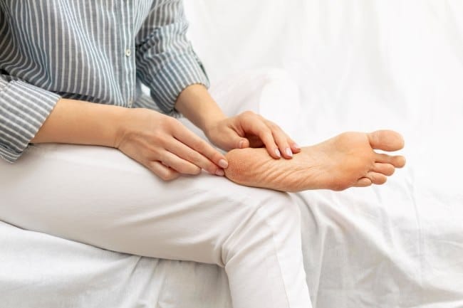 5 Cara Menghilangkan Kaki Pecah-Pecah secara Permanen - Alodokter