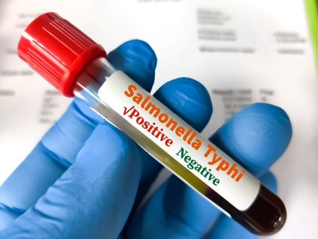 Salmonella Typhi, Kenali Penularan, Gejala, dan Cara Mencegahnya - Alodokter
