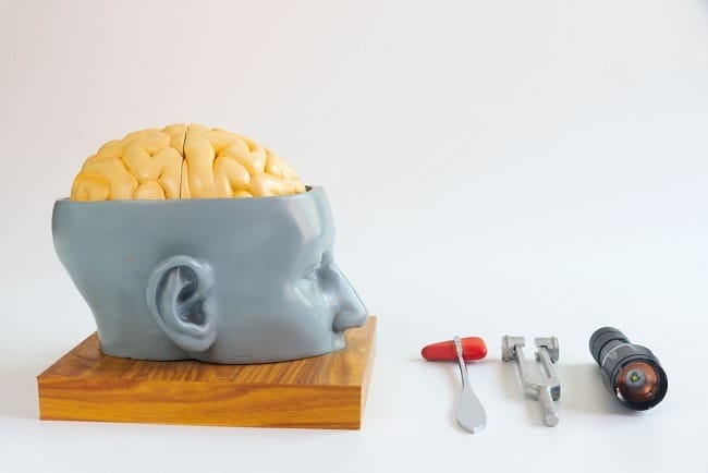 Lobotomi, Operasi Bedah Otak yang Tidak Lagi Digunakan - Alodokter