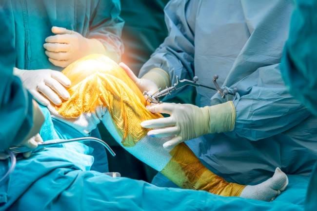Arthroplasty, Ketahui Persiapan dan Prosedur yang Dilakukan - Alodokter
