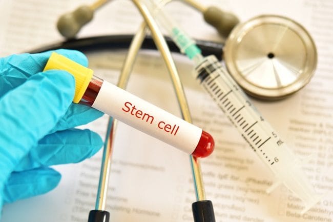 Terapi Stem Cell, Prosedur untuk Mengobati Kanker Darah - Alodokter