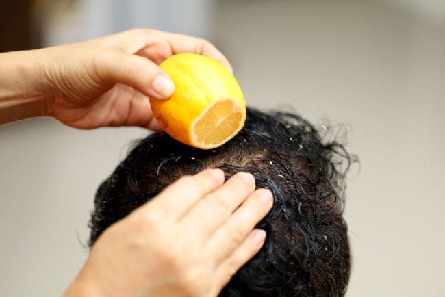 Lemon untuk Rambut, Bikin Rambut Lebih Subur dan Bebas Ketombe - Alodokter