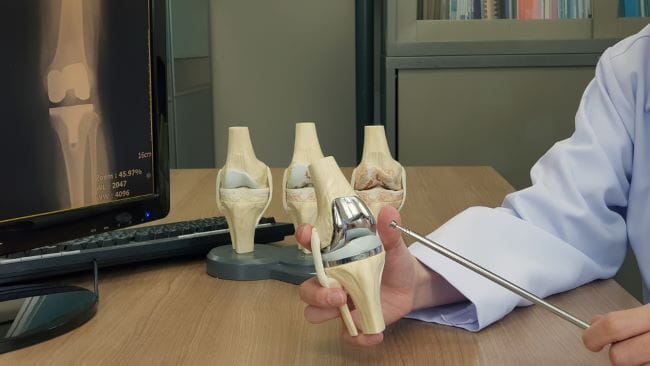 Total Knee Replacement, Ini yang Perlu Diketahui - Alodokter