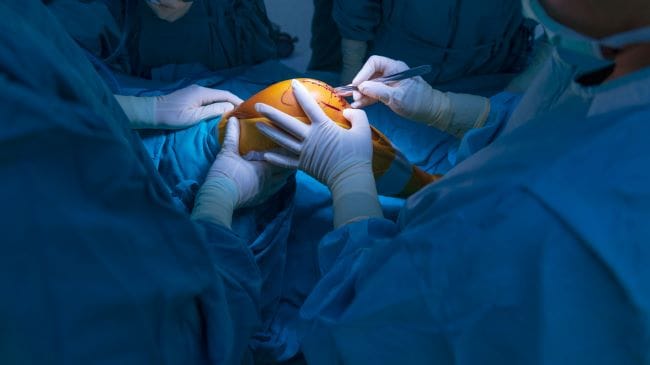 Operasi Ligamen Lutut, Ini yang Perlu Diketahui - Alodokter