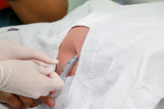 Torakoskopi, Ini yang Perlu Dipahami - Alodokter