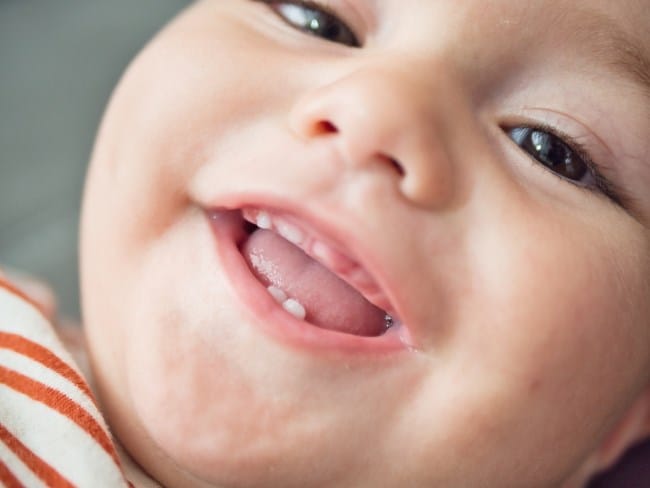 Pertumbuhan Gigi Bayi yang Tidak Normal, Ini Penyebab dan Penanganannya - Alodokter