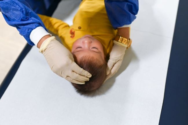 Ubun-Ubun Bayi Cekung, Ini Penyebab dan Cara Mengatasinya - Alodokter