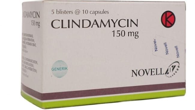 10 Obat Gusi Bengkak yang Ampuh Atasi Gejala dan Penyebabnya - Alodokter