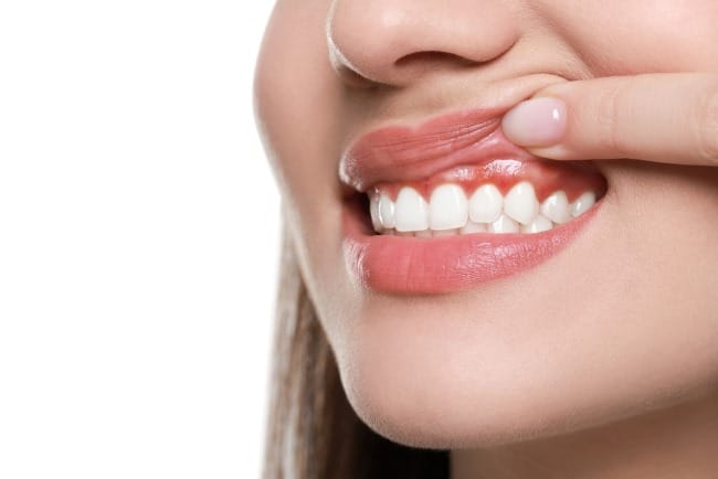 Daging Tumbuh di Gusi, Inilah Berbagai Penyebab dan Penanganannya - Alodokter