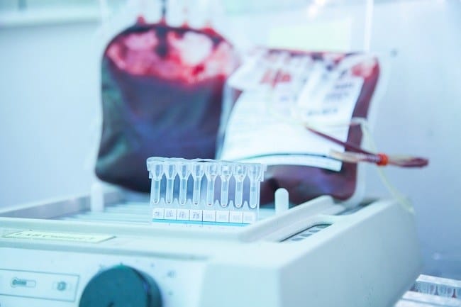 Tes Crossmatch, Ini Tujuan dan Prosedur Pelaksanaannya - Alodokter