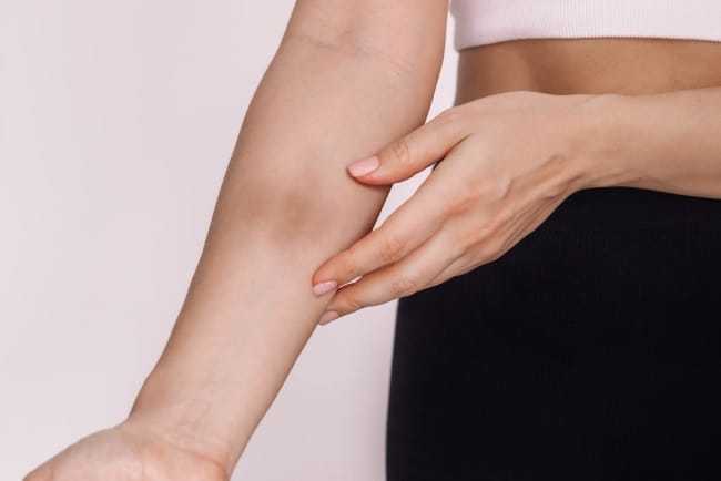 7 Ciri-Ciri Trombosit Turun yang Perlu Diketahui - Alodokter