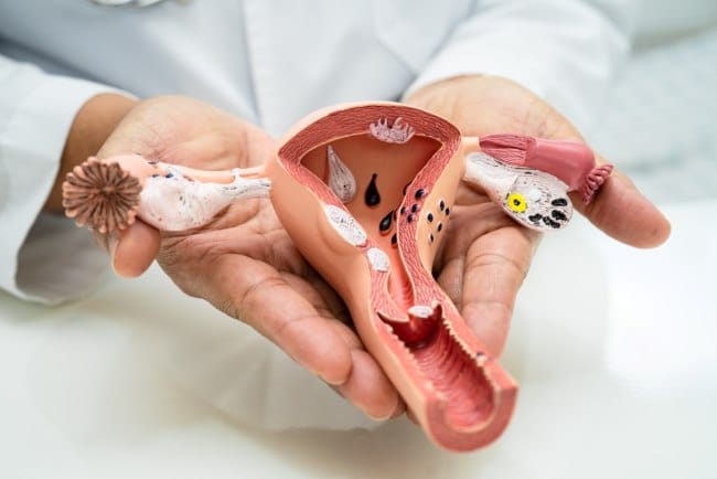 Fungsi Uterus dan Gangguan yang Dapat Terjadi - Alodokter