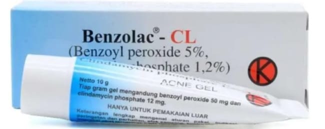 8 Obat Jerawat Punggung yang Ampuh dan Aman - Alodokter