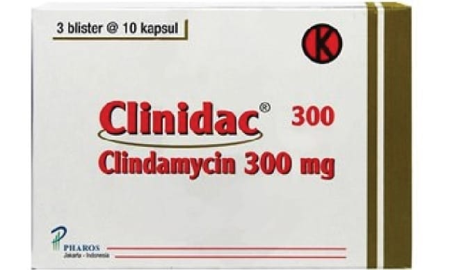 6 Obat Sakit Tulang yang Efektif Atasi Keluhan - Alodokter