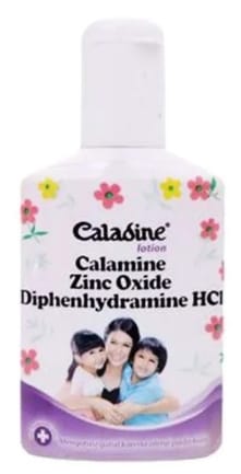 6 Obat Iritasi Kulit yang Efektif - Alodokter