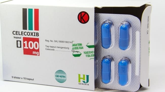 8 Obat Sakit Sendi yang Efektif - Alodokter