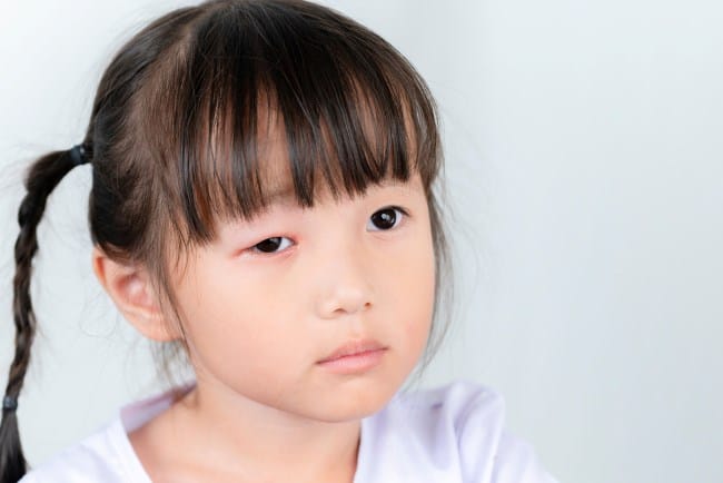 Benjolan di Kelopak Mata Anak, Kenali Penyebab dan Cara Mengatasinya - Alodokter