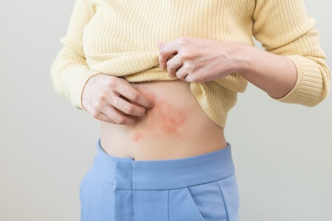 Badan Gatal-Gatal Bentol Tanpa Sebab, Begini Cara Mengatasinya - Alodokter