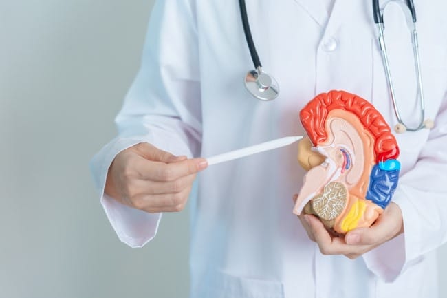 Penyumbatan Pembuluh Darah di Otak, Kenali Gejala dan Cara Mencegahnya - Alodokter