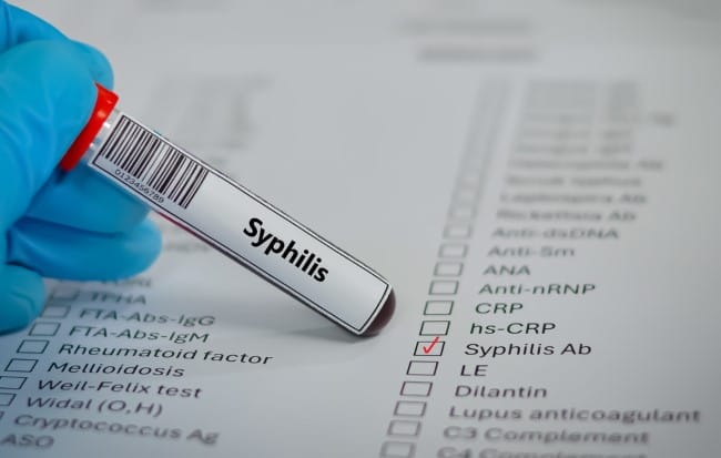 Treponema pallidum, Bakteri Penyebab Sifilis yang Perlu Diwaspadai - Alodokter