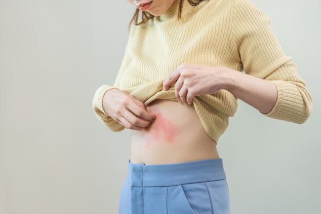 Gatal di Perut setelah Melahirkan, Ini Penyebab dan Cara Mengatasinya - Alodokter