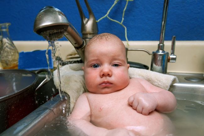 Congenital Ptosis, Kondisi Ketika Kelopak Mata Anak Tampak Turun - Alodokter