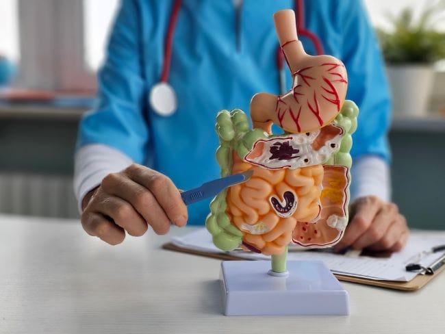 Usus Kecil, Ketahui Fungsi dan Gangguan yang Bisa Terjadi - Alodokter