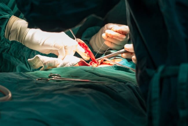 Operasi Usus Buntu Berapa Lama? Ketahui Estimasi Waktunya Sampai Pulih - Alodokter