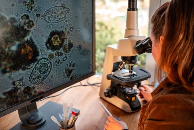 Amoeba, Kenali Ciri-Ciri, Jenis, dan Penyakit yang Dapat Ditimbulkannya - Alodokter