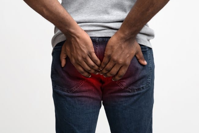Bisul di Anus, Inilah Penyebab dan Penanganannya - Alodokter