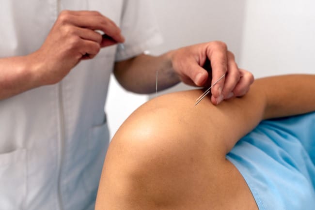 Dry Needling, Manfaat, Prosedur, dan Risiko yang Perlu Diketahui - Alodokter