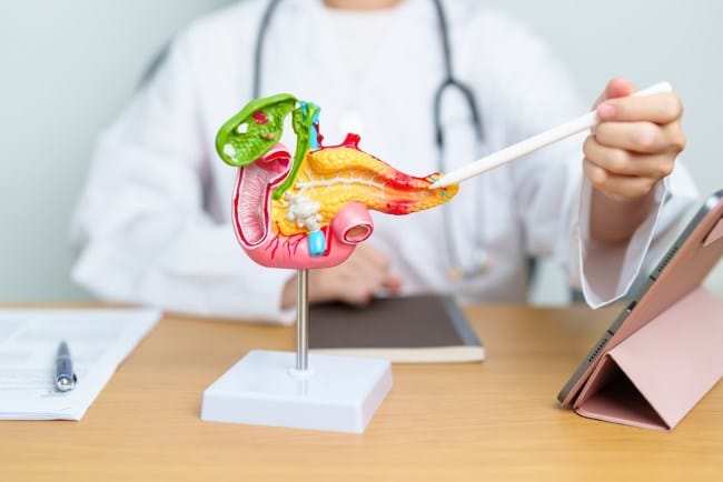 Tumor Pankreas: Penyebab, Gejala, dan Penanganannya - Alodokter