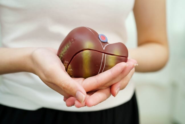 Fatty Liver Grade 1, Kenali Gejala, Penyebab, dan Penanganannya - Alodokter