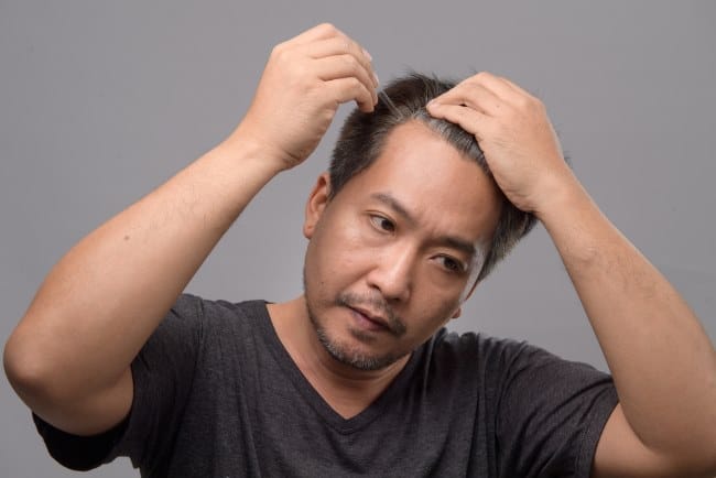 7 Vitamin Rambut Pria Andalan agar Sehat dan Tidak Gampang Rontok - Alodokter