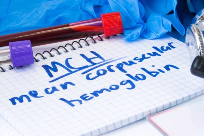 MCH, Pemeriksaan Penting untuk Deteksi Anemia - Alodokter