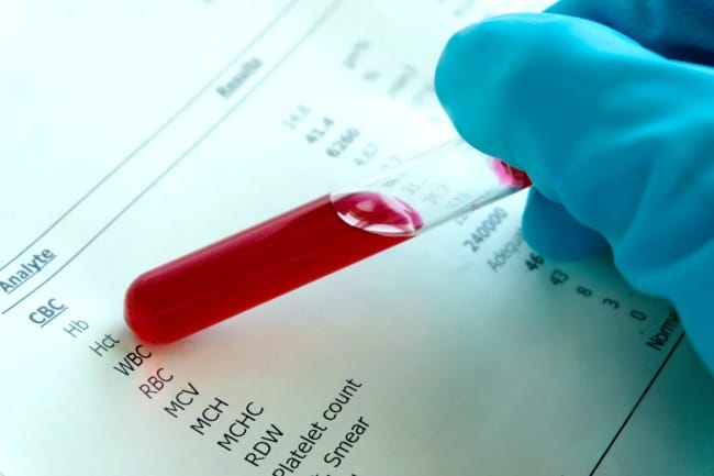 Leukosit: Fungsi, Jenis, dan Penyebab Kadarnya Tidak Normal - Alodokter