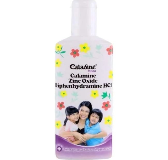 8 Obat Biduran Anak yang Efektif Meredakan Gatal - Alodokter