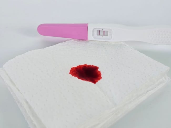 6 Cara Menghentikan Flek Saat Hamil Muda dengan Aman - Alodokter