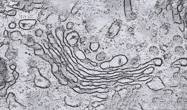 Fungsi Badan Golgi dan Risikonya Jika Terganggu - Alodokter