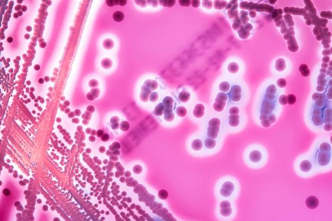 Streptococcus, Bakteri Penyebab Infeksi yang Perlu Diwaspadai - Alodokter