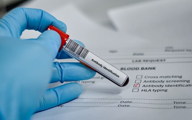 6 Perbedaan Antigen dan Antibodi yang Sering Keliru - Alodokter