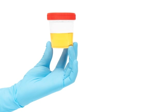 Cara Mengetahui Hamil dari Air Kencing, Mana yang Paling Akurat? - Alodokter