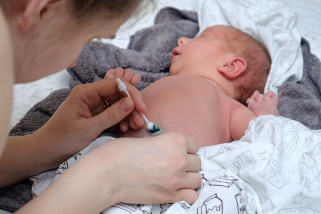 Pusar Bayi Berdarah, Kenali Penyebab dan Cara Mengatasinya - Alodokter