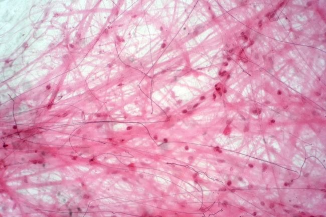 Jaringan Ikat, Ketahui Berbagai Jenis dan Fungsinya - Alodokter