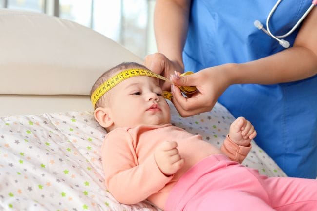 Perbedaan Bentuk Kepala Bayi Normal dan Tidak Normal yang Perlu Diketahui - Alodokter