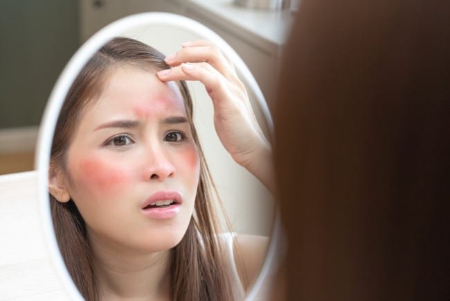 6 Ciri-Ciri Muka Alergi Kosmetik yang Perlu Diketahui - Alodokter