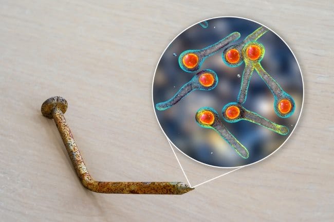 Clostridium tetani, Bakteri Berbahaya Penyebab Tetanus - Alodokter