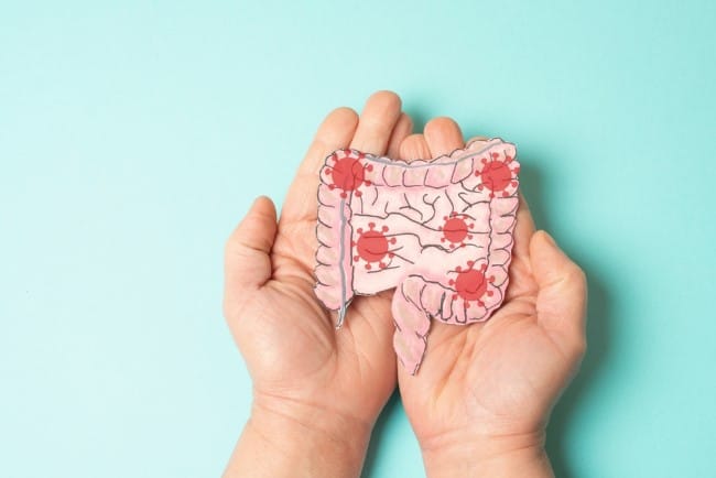 Ileum, Kenali Fungsi Pentingnya dalam Sistem Pencernaan - Alodokter